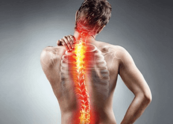  FAQs About Scoliosis