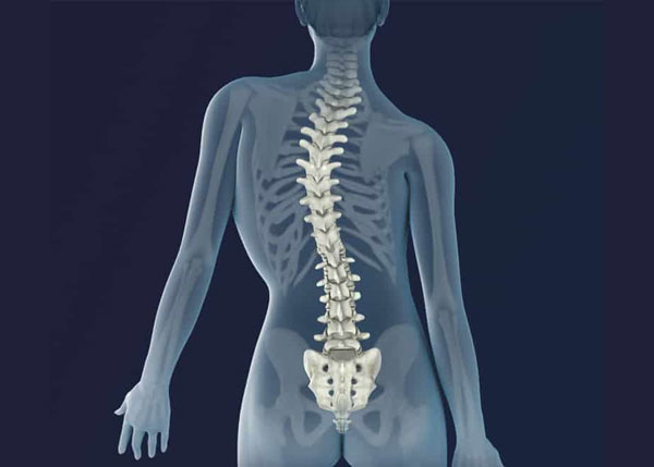  How is scoliosis diagnosed?