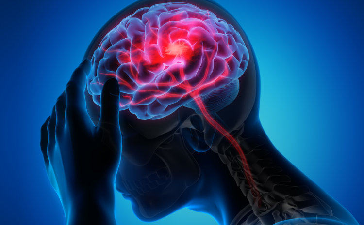  Headache: Causes & Treatment
